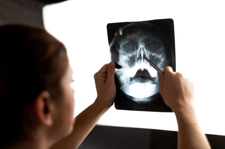 Person holding an xray of a human head up to a light board. They are holding the image in their left hand and pointing at the nasal cavity with a long silver instrument in their right hand. 